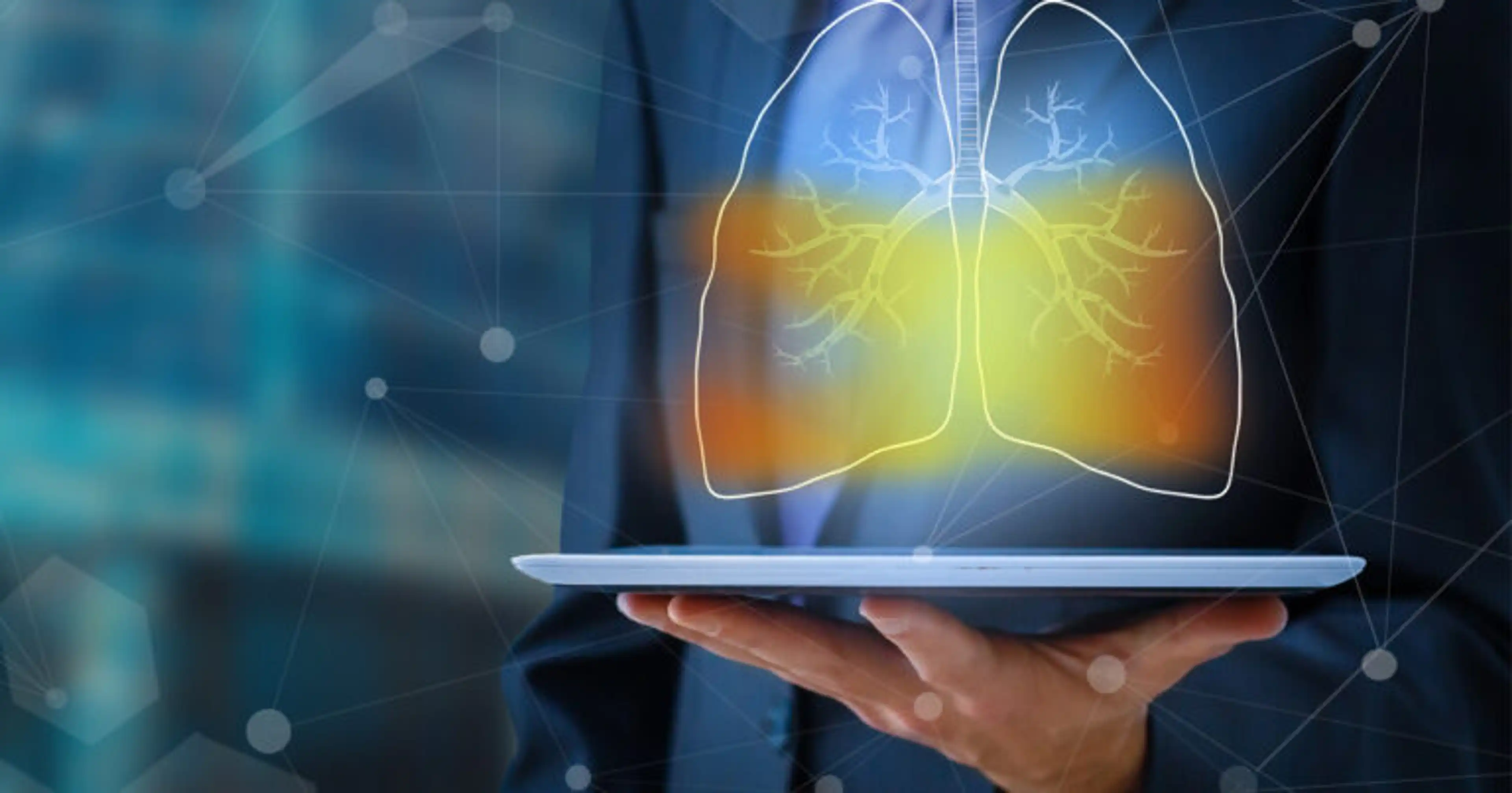 AI-Based Early Lung Cancer Detection Using CT Scans With Multiple Classification