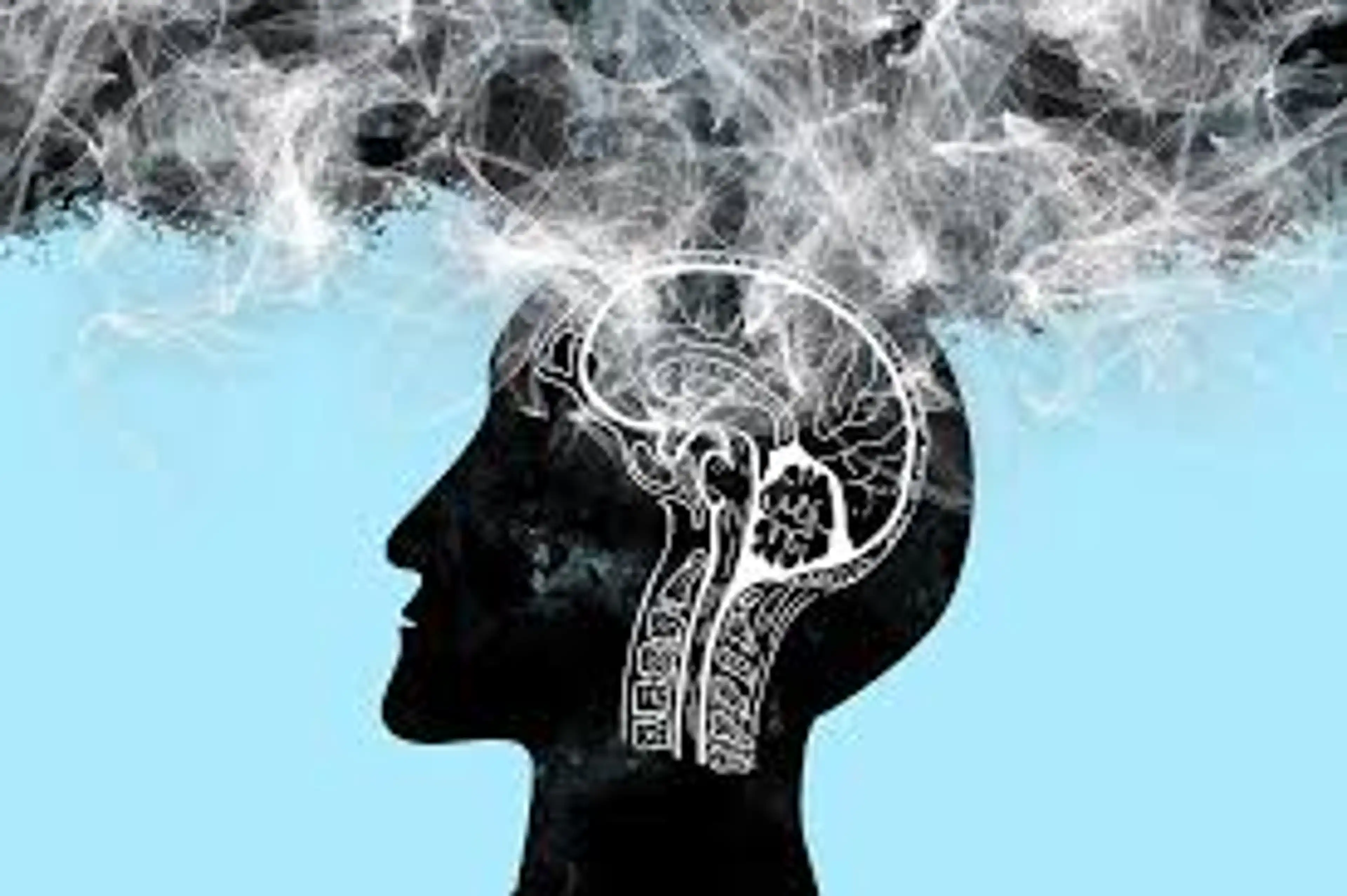 How Efficient are the CDR, MMSE, nWBV, and eTIV Values when Diagnosing a Patient with Dementia?