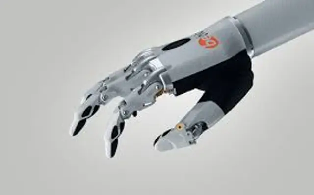 How AI can be integrated in a wrist prosthetic.