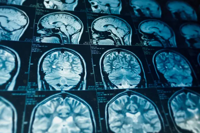 Wired and Tired: A Sleep Science from Neurobiology to Daily Struggles