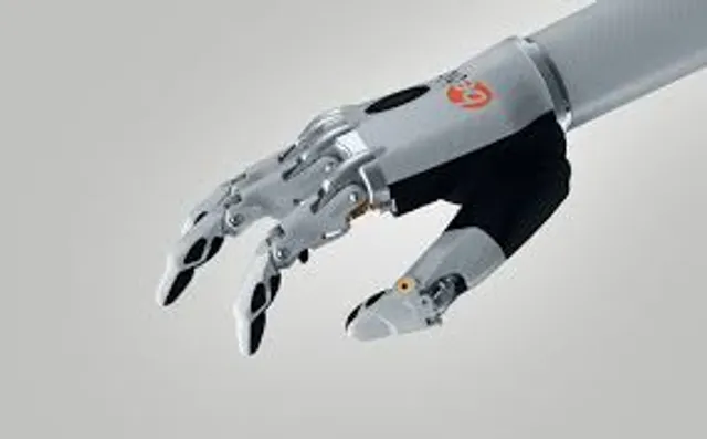How AI can be integrated in a wrist prosthetic.