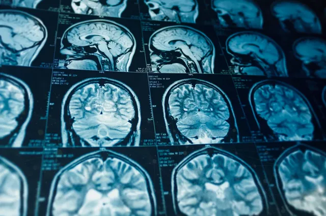Wired and Tired: A Sleep Science from Neurobiology to Daily Struggles