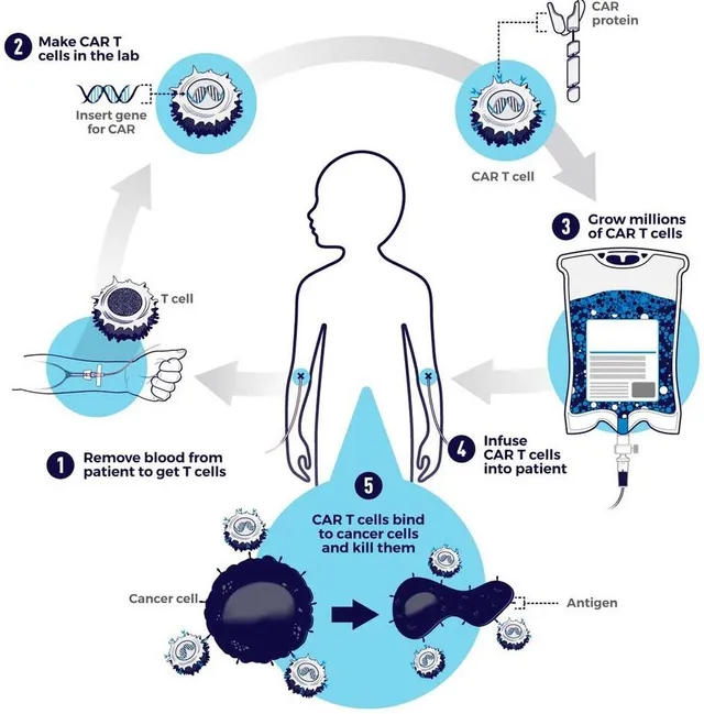 Systematic Review of CAR T-Cell Therapy for Cancer Treatment in Leukemia and Beyond: Applications, Limitations, and Promise